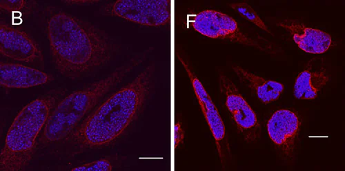 Immunocytochemistry/ Immunofluorescence - Anti-HSV1 ICP8 Major DNA binding protein antibody [11E2] (AB20194)