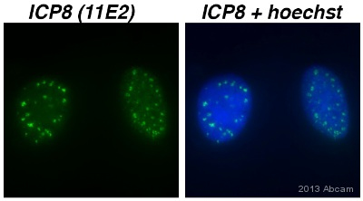 Immunocytochemistry/ Immunofluorescence - Anti-HSV1 ICP8 Major DNA binding protein antibody [11E2] (AB20194)