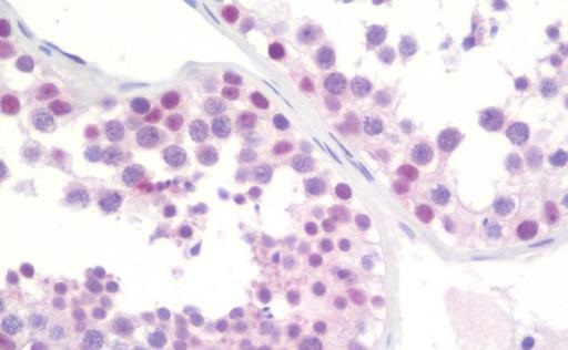 Immunohistochemistry (Formalin/PFA-fixed paraffin-embedded sections) - Anti-HTF9C/TRMT2A antibody [1G8] (AB230922), expandable thumbnail