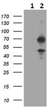 Western blot - Anti-HTF9C/TRMT2A antibody [1G8] (AB230922), expandable thumbnail