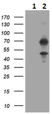 Western blot - Anti-HTF9C/TRMT2A antibody [1G8] (AB230922)
