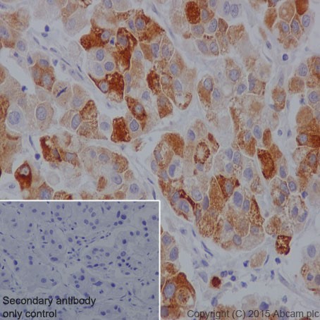 Immunohistochemistry (Formalin/PFA-fixed paraffin-embedded sections) - Anti-HTF9C/TRMT2A antibody [EPR16485-54] (AB205616), expandable thumbnail