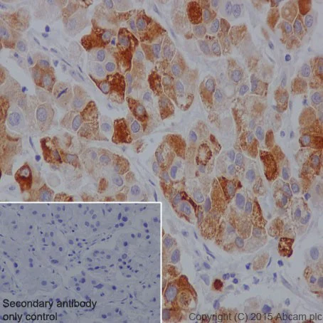 Immunohistochemistry (Formalin/PFA-fixed paraffin-embedded sections) - Anti-HTF9C/TRMT2A antibody [EPR16485-54] (AB205616)