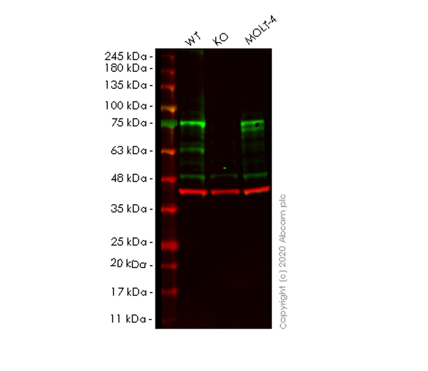 Western blot - Anti-HTF9C/TRMT2A antibody [EPR16485-54] (AB205616), expandable thumbnail