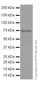 Western blot - Anti-HTF9C/TRMT2A antibody [EPR16485-54] (AB205616), expandable thumbnail