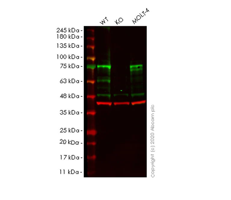 Western blot - Anti-HTF9C/TRMT2A antibody [EPR16485-54] - BSA and Azide free (AB251437)