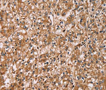 Immunohistochemistry (Formalin/PFA-fixed paraffin-embedded sections) - Anti-HTR3C antibody (AB199148), expandable thumbnail