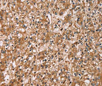 Immunohistochemistry (Formalin/PFA-fixed paraffin-embedded sections) - Anti-HTR3C antibody (AB199148)