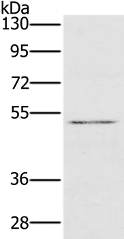 Western blot - Anti-HTR3C antibody (AB199148)