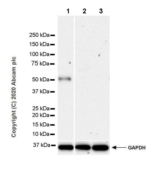 Western blot - Anti-htrA1 antibody [EPR23240-64] (AB274322), expandable thumbnail