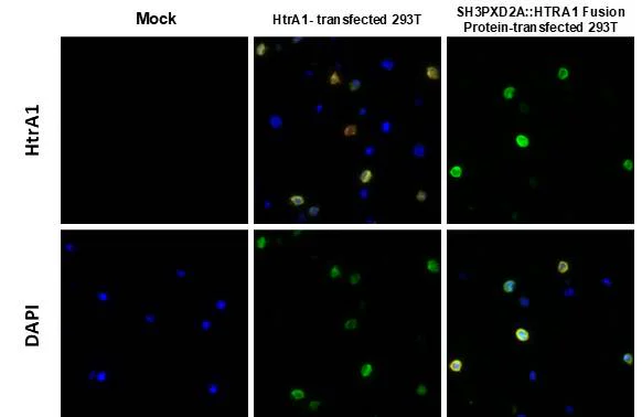 Immunohistochemistry (Formalin/PFA-fixed paraffin-embedded sections) - Anti-HtrA1 antibody [HL3878] - BSA and Azide free (AB327514)