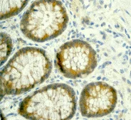 Immunohistochemistry (Formalin/PFA-fixed paraffin-embedded sections) - Anti-HtrA2 / Omi antibody [EPR22] (AB75982)