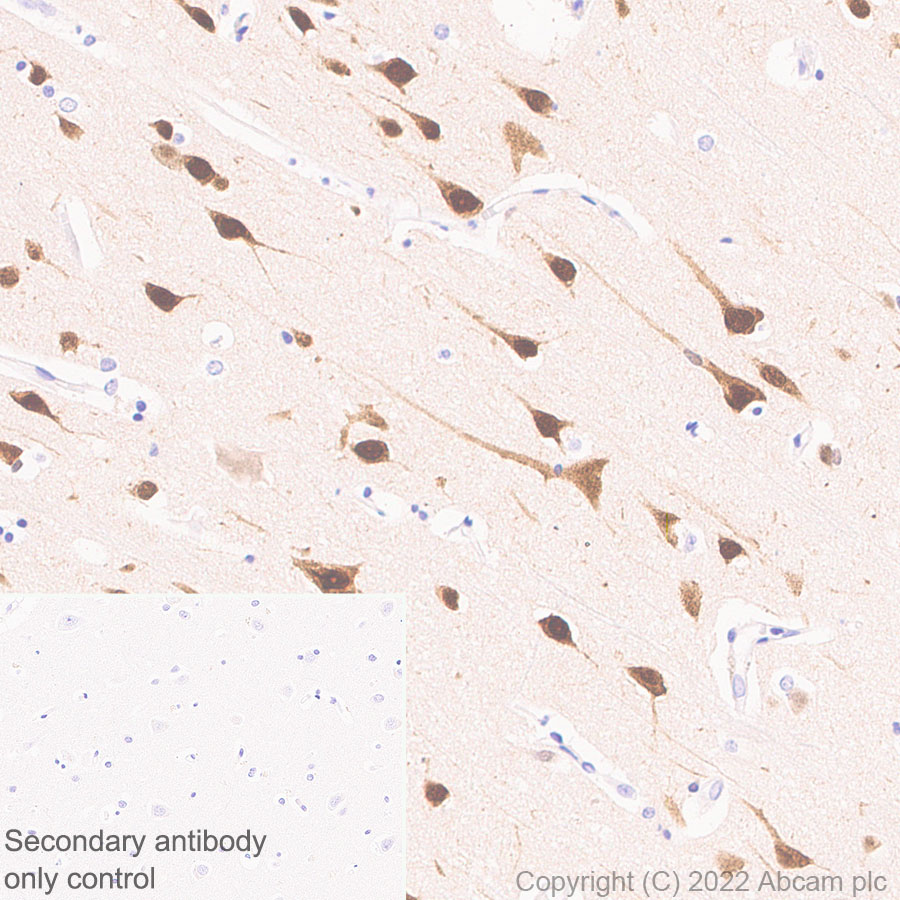 Immunohistochemistry (Formalin/PFA-fixed paraffin-embedded sections) - Anti-HuD antibody [EPR26472-54] (BSA and Azide free) (ab302515), expandable thumbnail