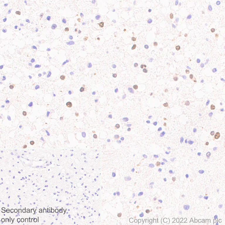 Immunohistochemistry (Formalin/PFA-fixed paraffin-embedded sections) - Anti-HuD antibody [EPR26472-54] (BSA and Azide free) (AB302515)