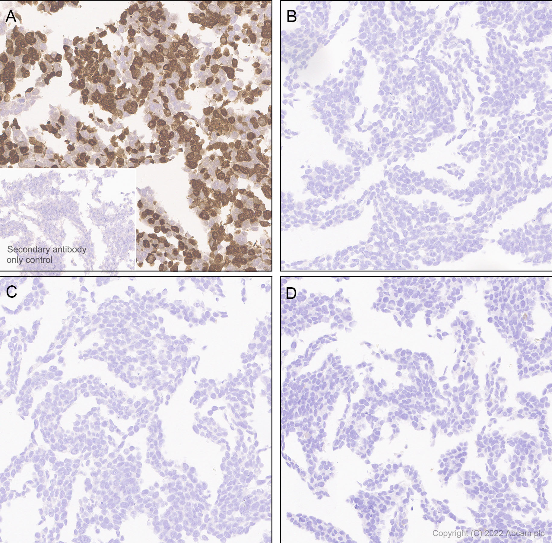 Immunohistochemistry (Formalin/PFA-fixed paraffin-embedded sections) - Anti-HuD antibody [EPR26472-54] (BSA and Azide free) (AB302515), expandable thumbnail