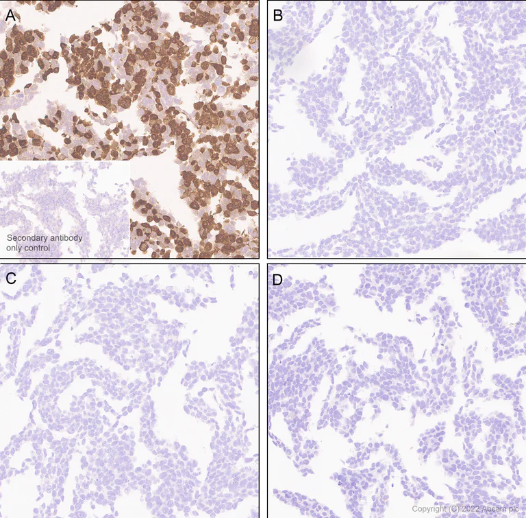 Immunohistochemistry (Formalin/PFA-fixed paraffin-embedded sections) - Anti-HuD antibody [EPR26472-54] (BSA and Azide free) (AB302515)