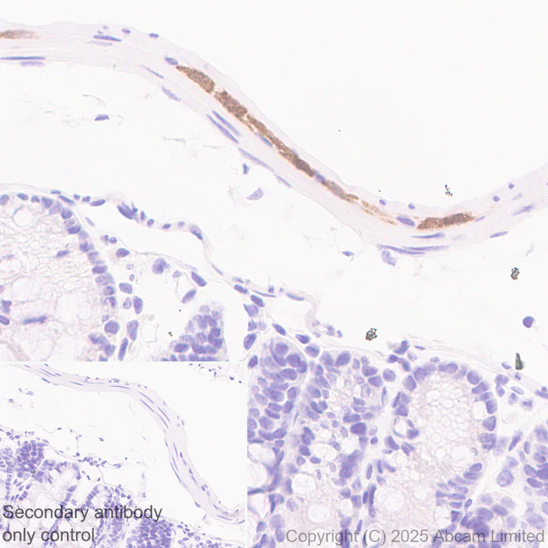 Immunohistochemistry (Formalin/PFA-fixed paraffin-embedded sections) - Anti-HuD antibody [EPR29580-516] (AB324613)