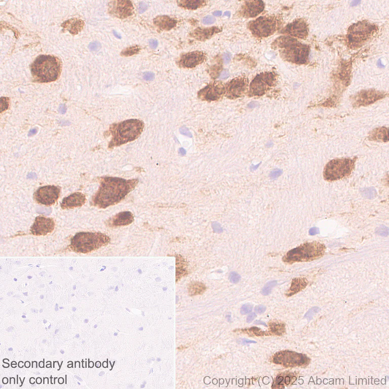 Immunohistochemistry (Formalin/PFA-fixed paraffin-embedded sections) - Anti-HuD antibody [EPR29580-516] (AB324613)