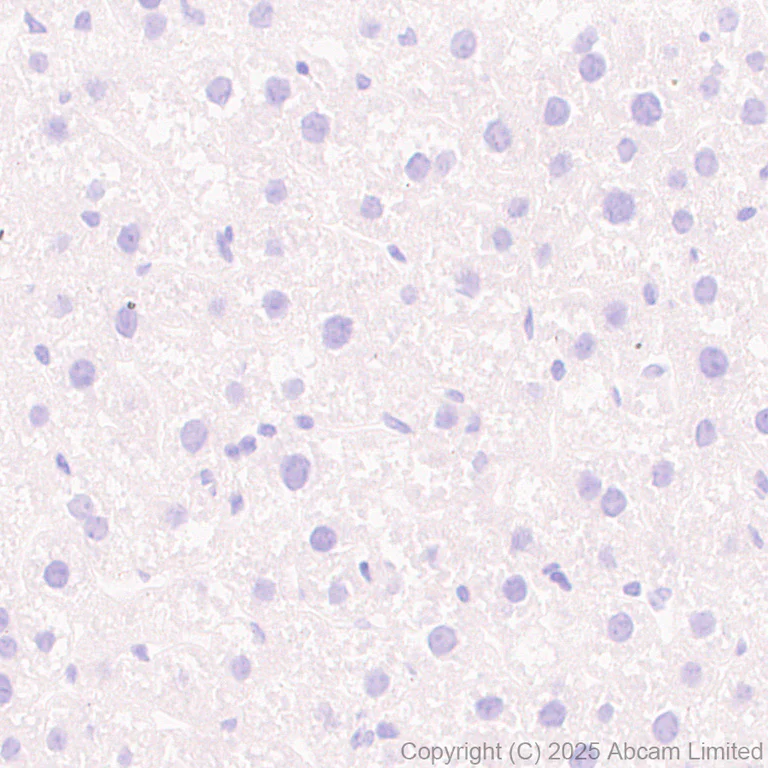 Immunohistochemistry (Formalin/PFA-fixed paraffin-embedded sections) - Anti-HuD antibody [EPR29580-516] (AB324613)