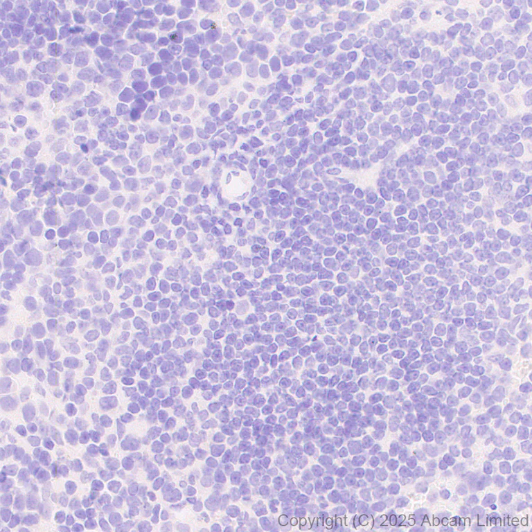 Immunohistochemistry (Formalin/PFA-fixed paraffin-embedded sections) - Anti-HuD antibody [EPR29580-516] (AB324613)