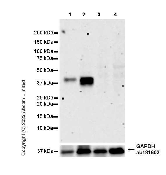 Western blot - Anti-HuD antibody [EPR29580-516] (AB324613)