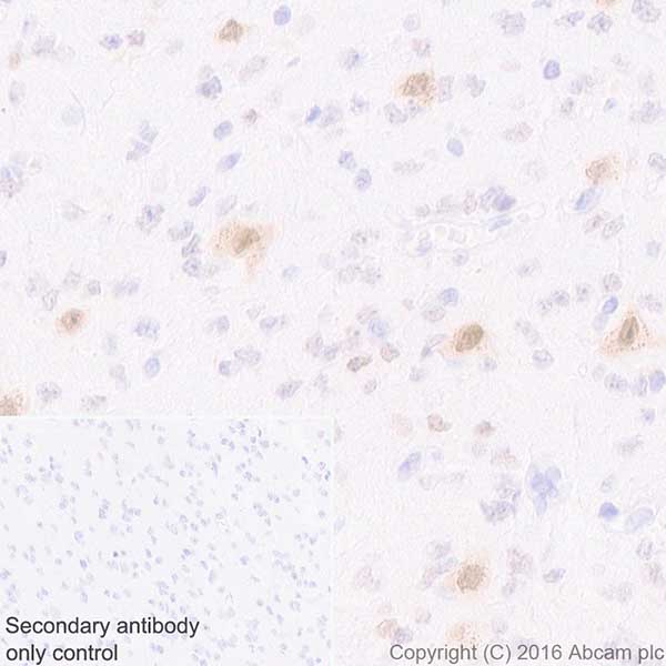 Immunohistochemistry (Formalin/PFA-fixed paraffin-embedded sections) - Anti-HuD + HuC antibody [EPR19098] (AB184267)