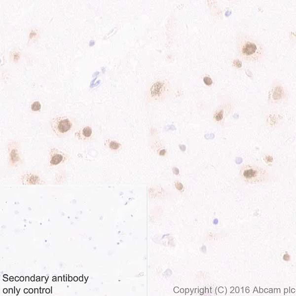 Immunohistochemistry (Formalin/PFA-fixed paraffin-embedded sections) - Anti-HuD + HuC antibody [EPR19098] (AB184267)
