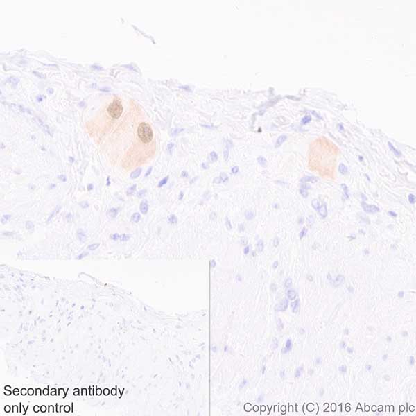 Immunohistochemistry (Formalin/PFA-fixed paraffin-embedded sections) - Anti-HuD + HuC antibody [EPR19098] (AB184267)
