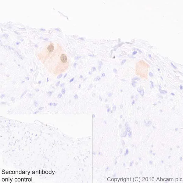 Immunohistochemistry (Formalin/PFA-fixed paraffin-embedded sections) - Anti-HuD + HuC antibody [EPR19098] (AB184267)
