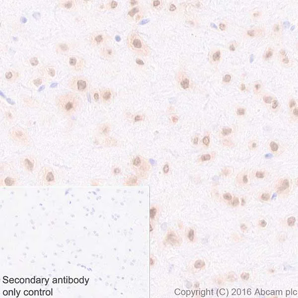 Immunohistochemistry (Formalin/PFA-fixed paraffin-embedded sections) - Anti-HuD + HuC antibody [EPR19098] - BSA and Azide free (AB232416)