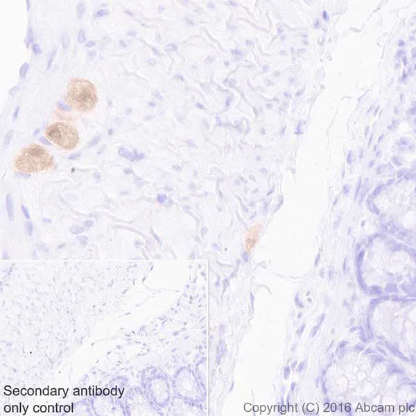 Immunohistochemistry (Formalin/PFA-fixed paraffin-embedded sections) - Anti-HuD + HuC antibody [EPR19098] - BSA and Azide free (AB232416)