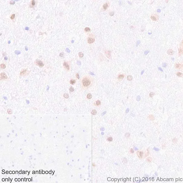 Immunohistochemistry (Formalin/PFA-fixed paraffin-embedded sections) - Anti-HuD + HuC antibody [EPR19098] - BSA and Azide free (AB232416)