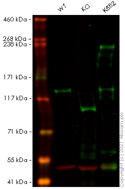 Human ABL1 knockout HeLa cell line
