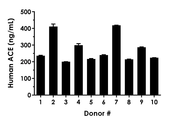Sandwich ELISA - Human ACE ELISA Kit (AB263889)