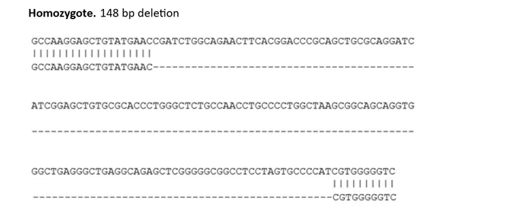 Sanger Sequencing - Human ACE knockout SK-N-FI cell line (AB288707)