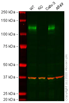 Western blot - Human ACE2 knockout Caco-2 cell line (AB273731)