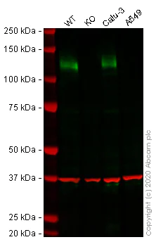 Western blot - Human ACE2 knockout Caco-2 cell line (AB273731)