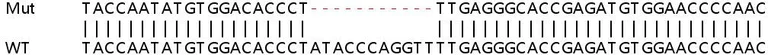 Sanger Sequencing - Human ACHE (Acetylcholinesterase) knockout HeLa cell line (AB261818)