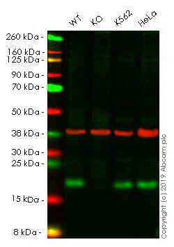 Western blot - Human ACP1 (Acid phosphatase) knockout HEK-293 cell line (AB261859)