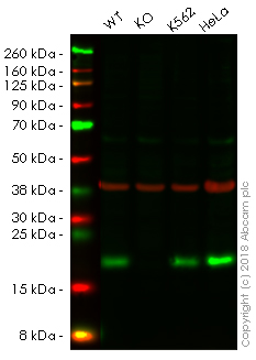 Western blot - Human ACP1 (Acid phosphatase) knockout HEK-293 cell line (AB261859)