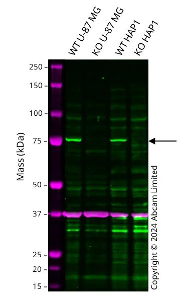 Western blot - Human ACSS2 knockout U-87 MG cell line (AB326072)