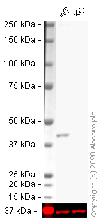 Western blot - Human ACTA2 knockout HeLa cell lysate (AB264499), expandable thumbnail
