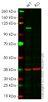 Western blot - Human ACTN1 (alpha Actinin) knockout HeLa cell lysate (AB257337)