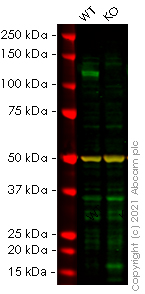 Western blot - Human ADAM17 knockout HeLa cell line (AB264911), expandable thumbnail