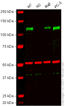 Western blot - Human ADAM17 knockout K-562 cell lysate (AB280104)