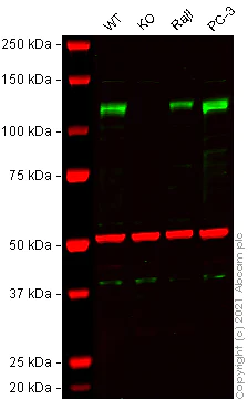 Western blot - Human ADAM17 knockout K-562 cell lysate (AB280104)
