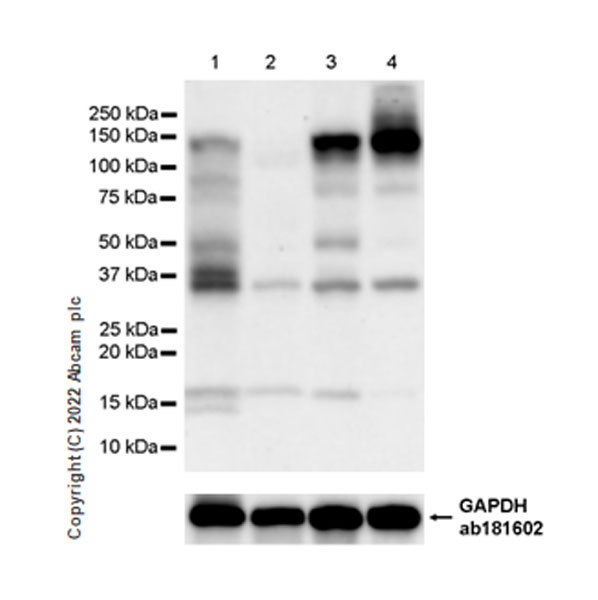 Western blot - Human ADAR (ADAR1) knockout HEK-293T cell line (ab266846), expandable thumbnail