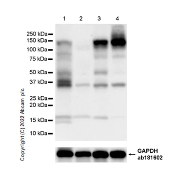 Western blot - Human ADAR (ADAR1) knockout HEK-293T cell lysate (AB257131)