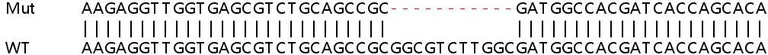 Sanger Sequencing - Human ADRB1 (beta 1 Adrenergic Receptor) knockout HeLa cell line (AB261831)