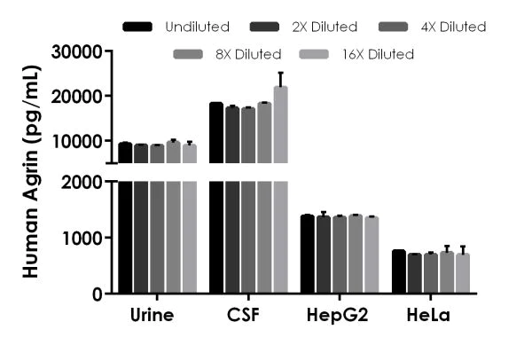 Sandwich ELISA - Human Agrin ELISA Kit (AB216945)